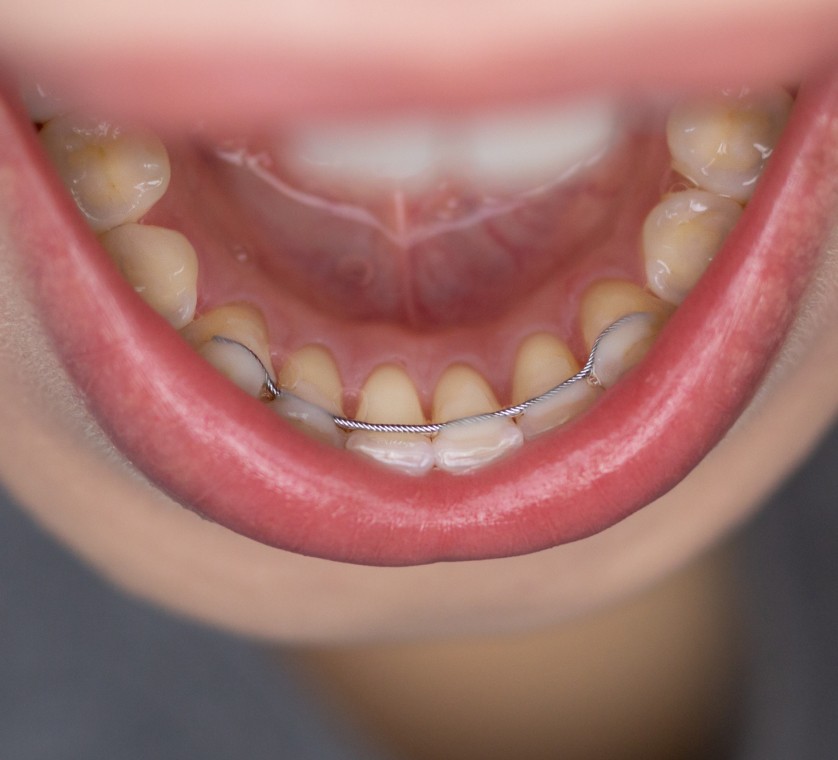 Conetion au cabinet d'orthodontie du Dr Renaud à Neufchateau