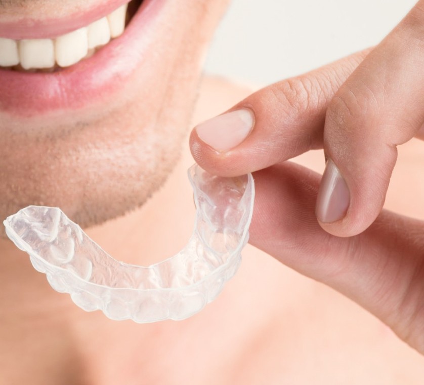 Gouttières invisibles au cabinet d'orthodontie du Dr Renaud à Neufchateau