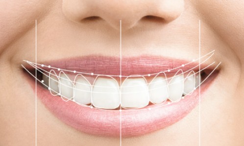Retrouvez votre sourire smile design