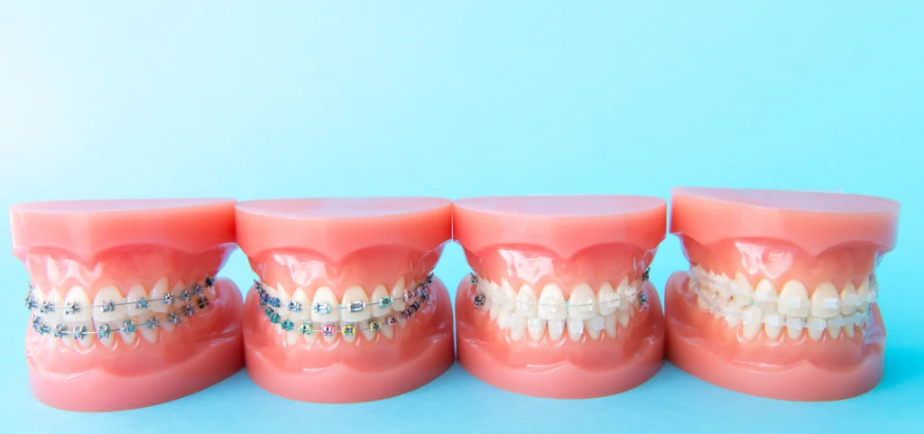 Orthodontie près de Chaumont