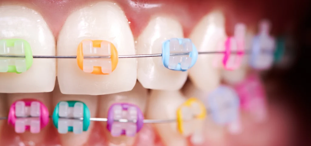 Orthodontie près de Vaucouleurs